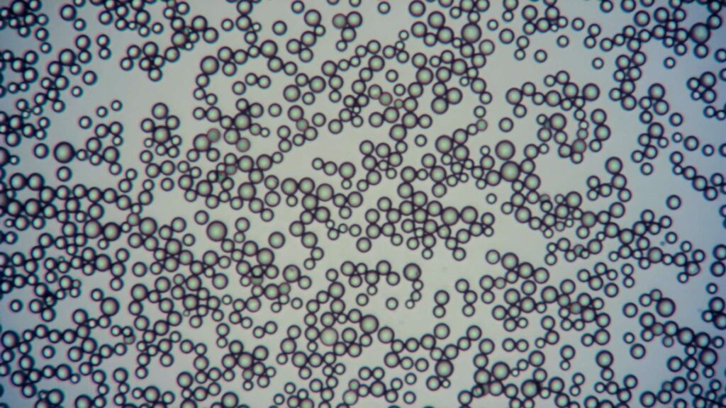 Example of 10 µm particles at 100x magnification